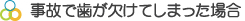 事故で歯が欠けてしまった場合